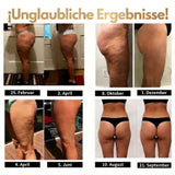 Cellumafit 3D Legging – Definieren Sie Ihre Silhouette mühelos neu