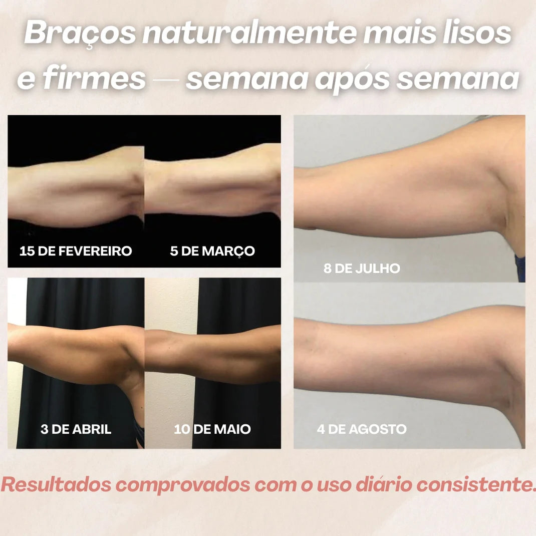Cellumove 3D Mangas Modeladoras – Acabaram-se os braços flácidos