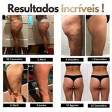 Cellumafit 3D Legging – Definieren Sie Ihre Silhouette mühelos neu